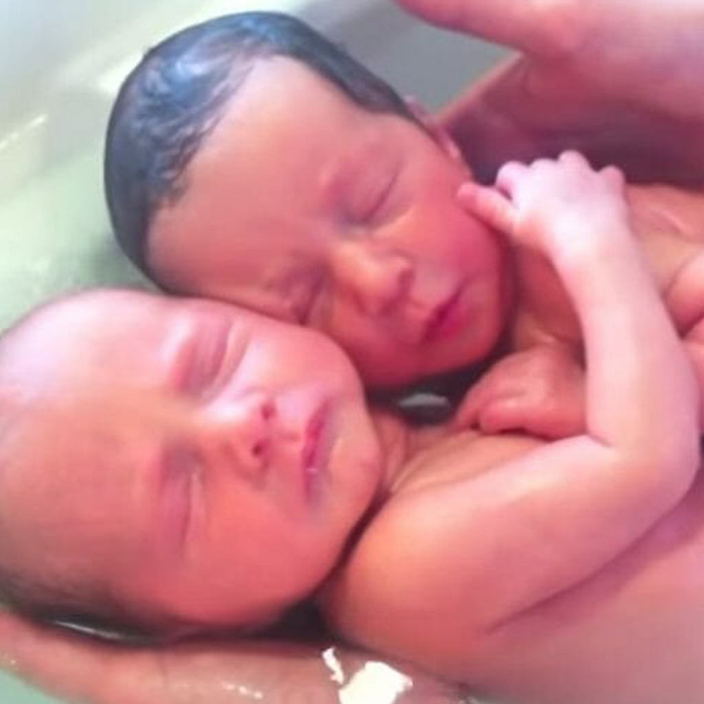 Touching!!! Twin infants continue to cuddle like they did in the womb.