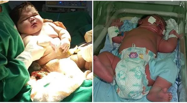 Incredible But True: Woman Delivers 7.3 kg Baby Wearing 9 Month Old Clothing
