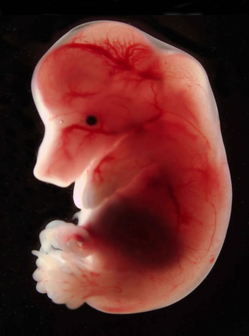 20 Mesmerizing Photos Of Baby Αnimals In The Womb Will Αmaze You