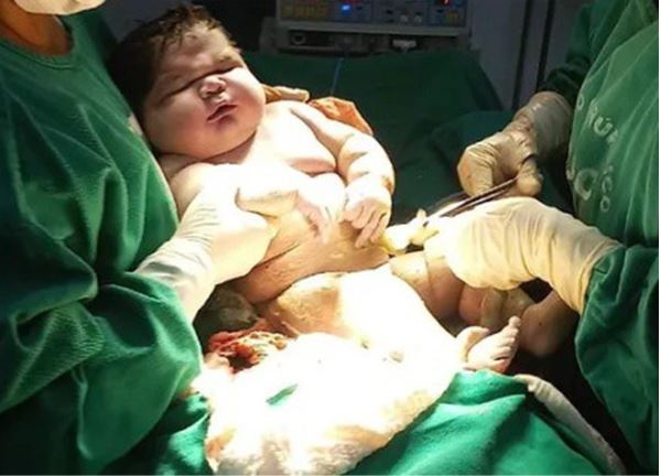 Incredible But True: Woman Delivers 7.3 kg Baby Wearing 9 Month Old Clothing