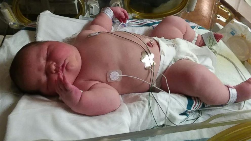 'I felt like I was looking at a toddler,' says the mother of a 13-pound newborn.