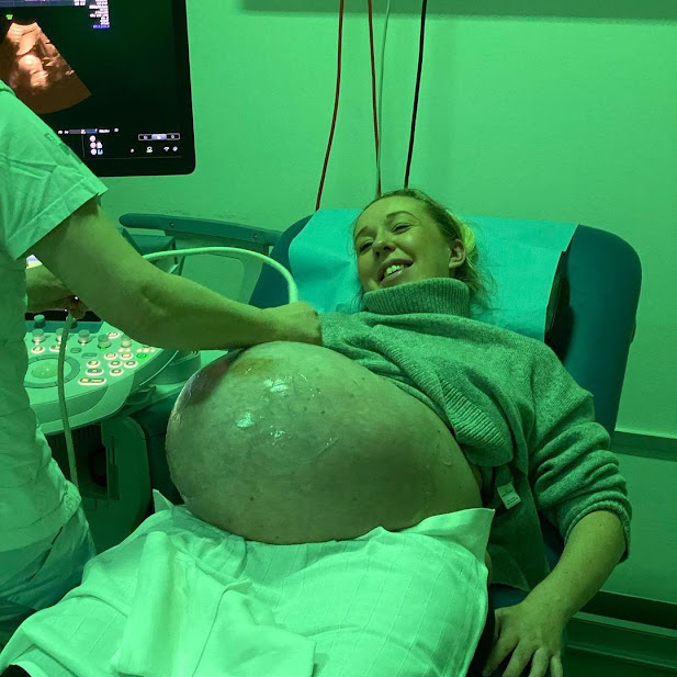 A TikTok video of a Danish mother giving birth to triplets after having twins went viral.