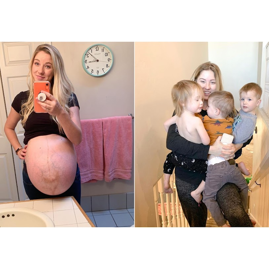 Mother of Triplets Posts Incredible Before-And-After Pregnancy Photographs