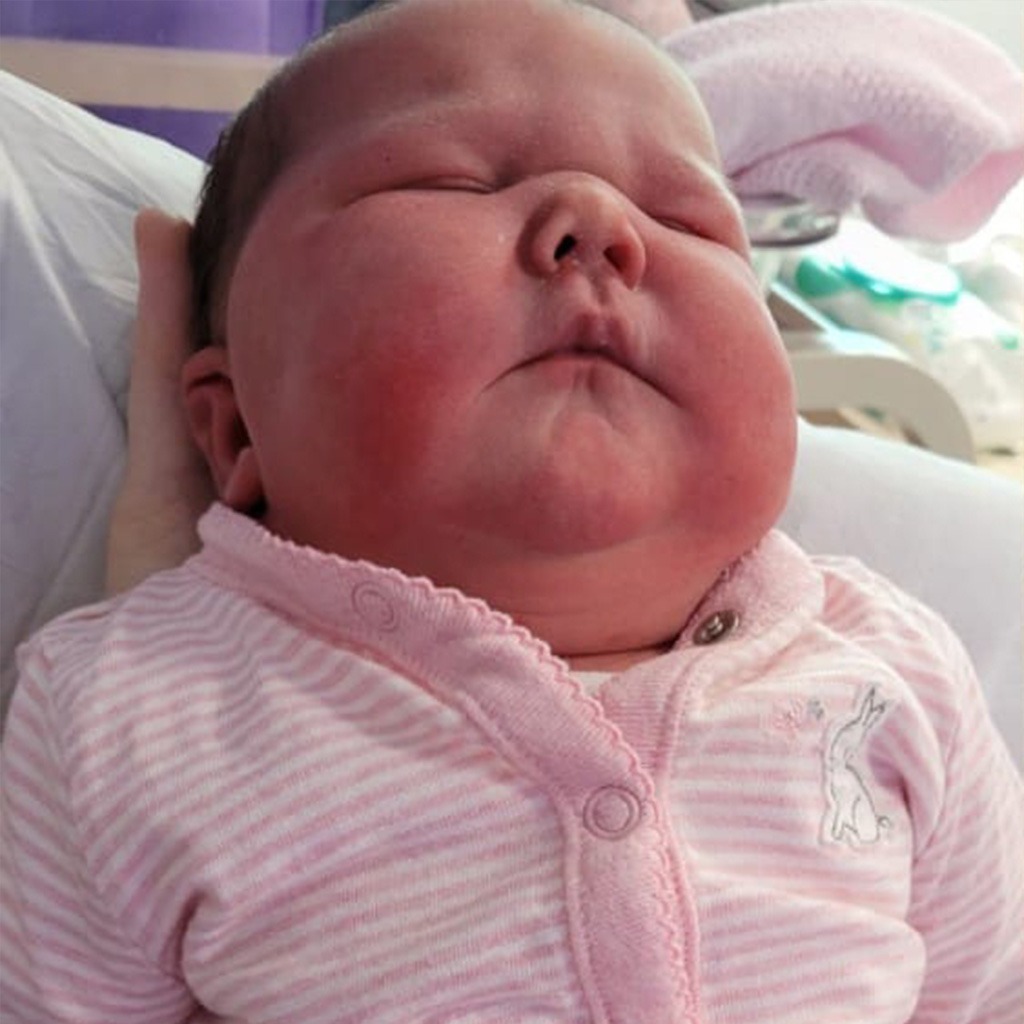 11-pound baby delivered by woman couldn't fit in newborn clothing