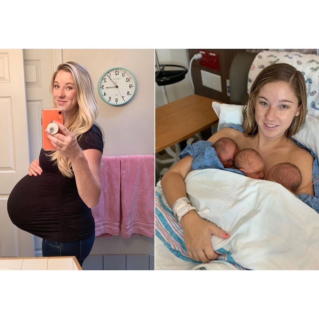 Mother of Triplets Posts Incredible Before-And-After Pregnancy Photographs