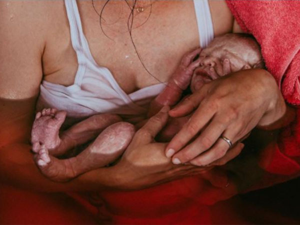 Crucial moments in the entire birth process are captured in the best photographs.