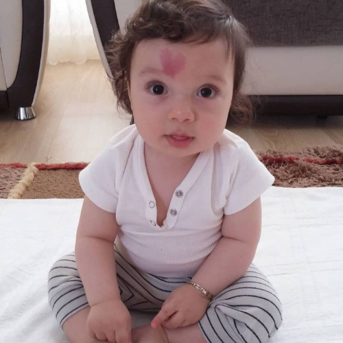 A Cute Baby Boy Was Born With A Birthmark In The Form Of A Heart.