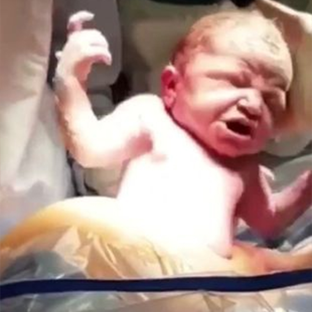 Mum And Dad In Hysterics After Baby Gives Incredible Scowl Moments After C-sᴇᴄᴛɪᴏɴ