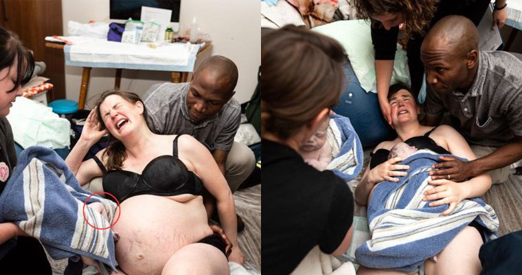 Unforgettable Moments: Home Birth Of Twins Caught On Camera