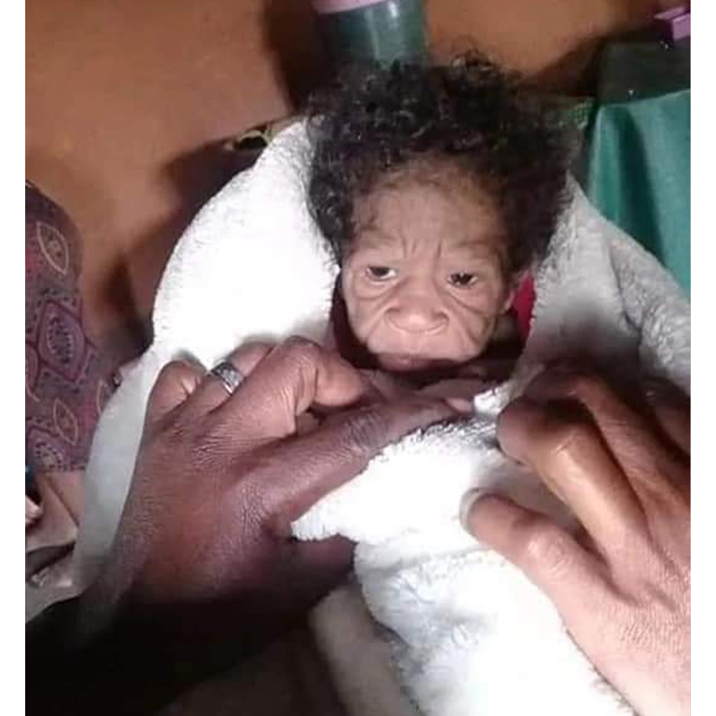 A woman has given birth to a baby girl who resembles