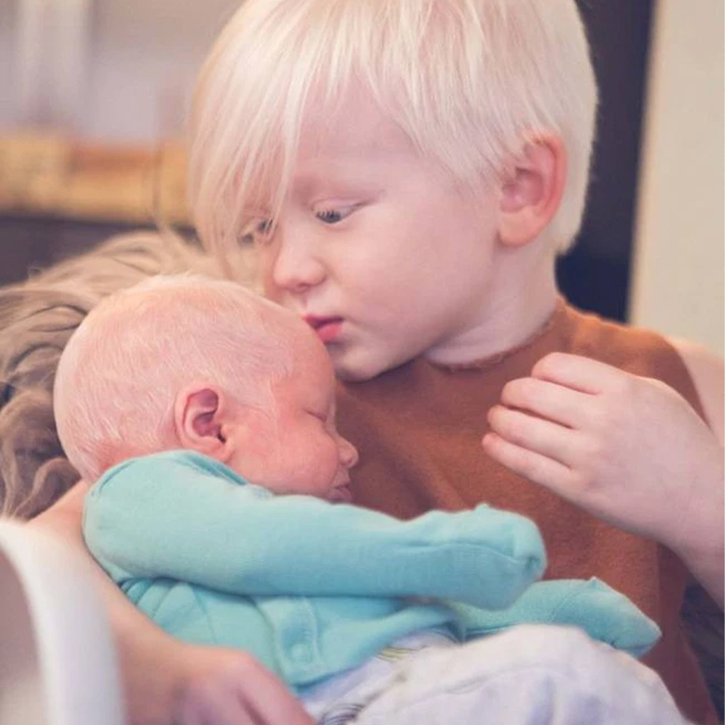 Mum was overjoyed when her baby was born with striking white hair - movingworl.com