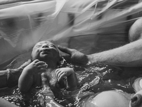 Crucial moments in the entire birth process are captured in the best photographs.