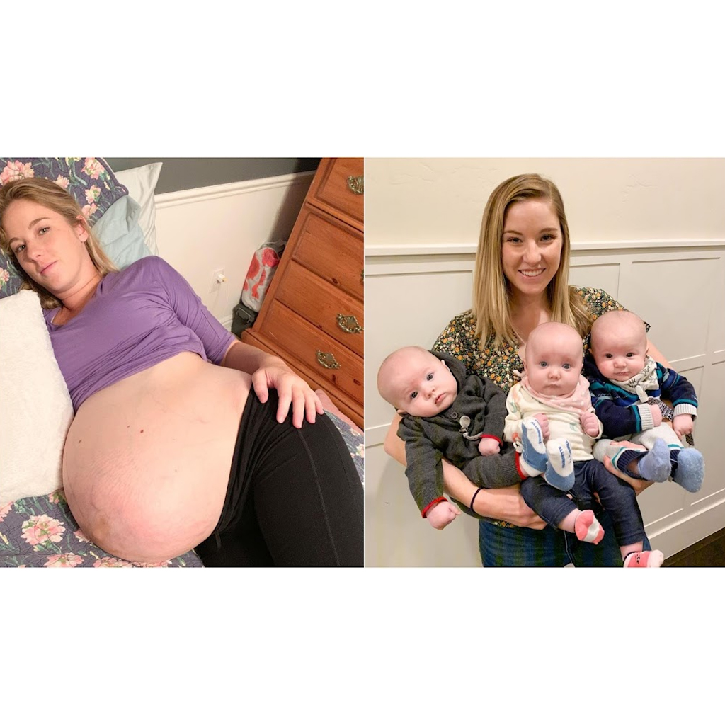 Mother of Triplets Posts Incredible Before-And-After Pregnancy Photographs