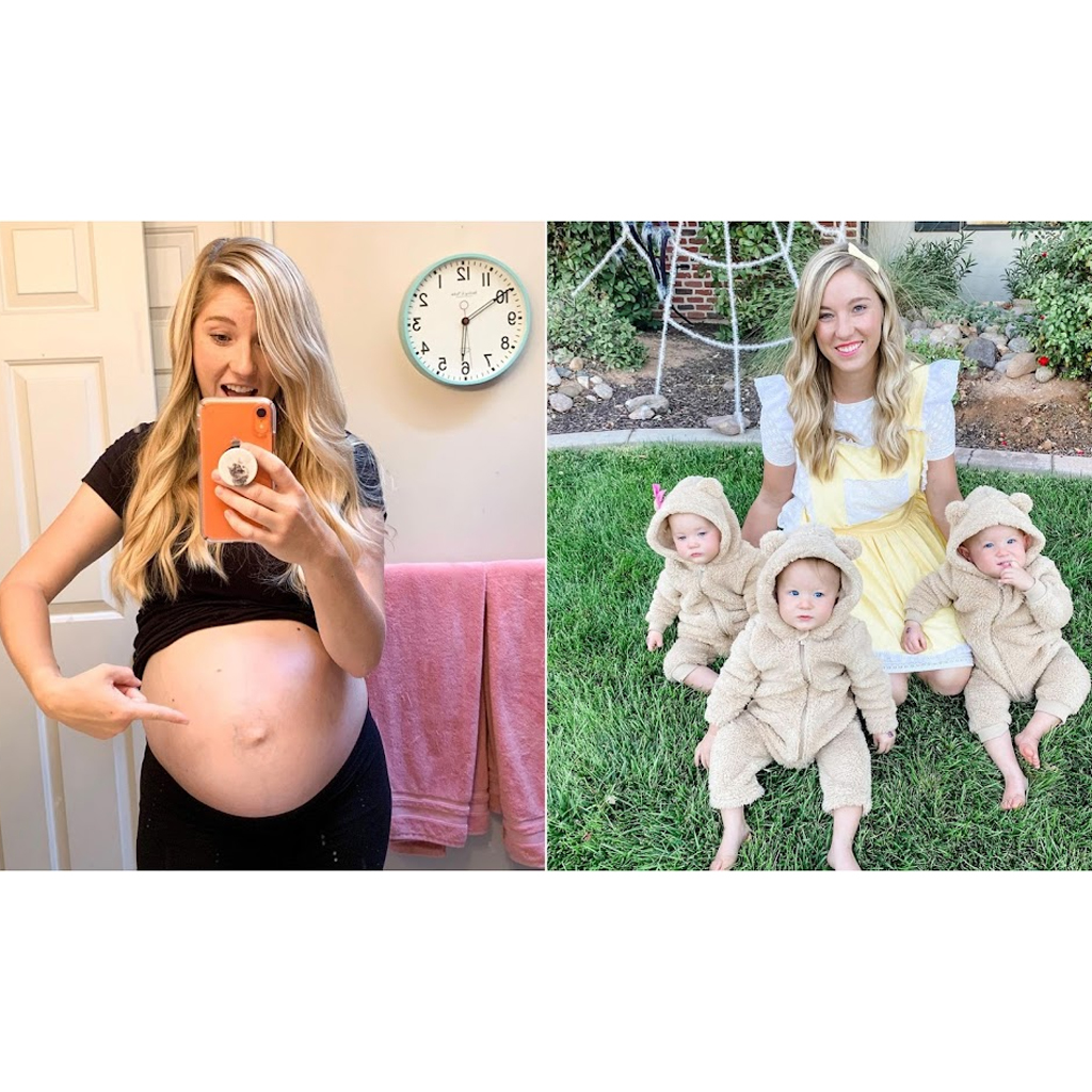 Mother of Triplets Posts Incredible Before-And-After Pregnancy Photographs