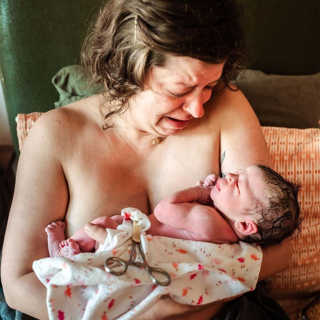 The Miracle Of Birth: Photographs Of Childbirth In The Hospital, At Home, And On The Water