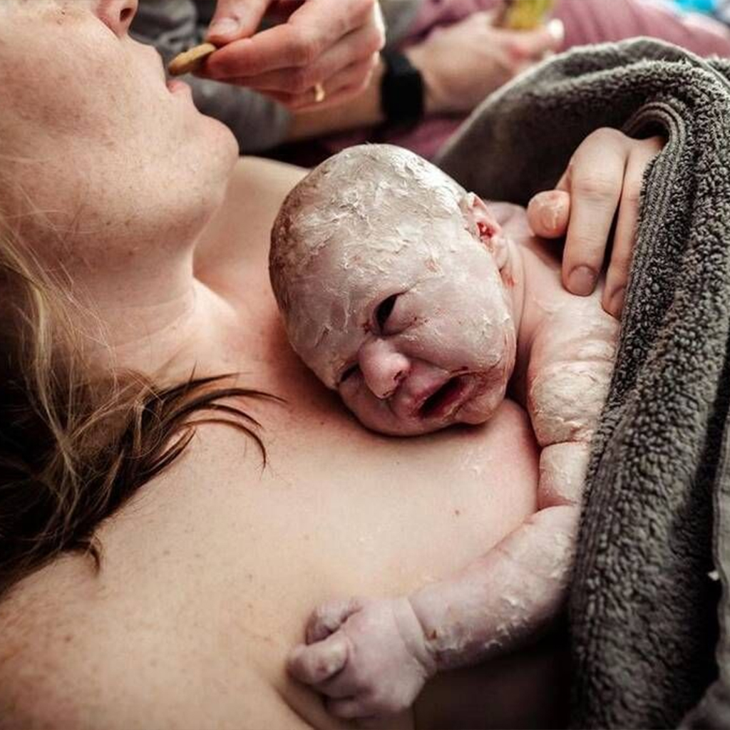 These photographs depict newborns with fetal sebum