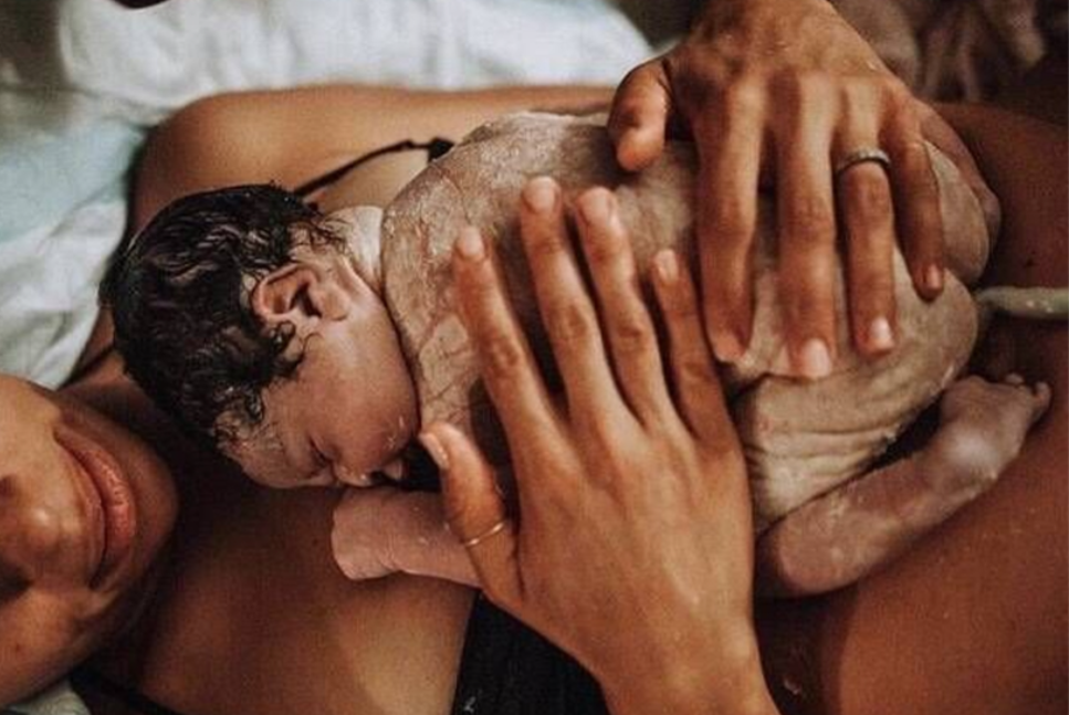 These photographs depict newborns with fetal sebum