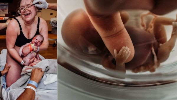 16 Amazing Birth Pictures That Demonstrate the Power And Beauty of Childbirth