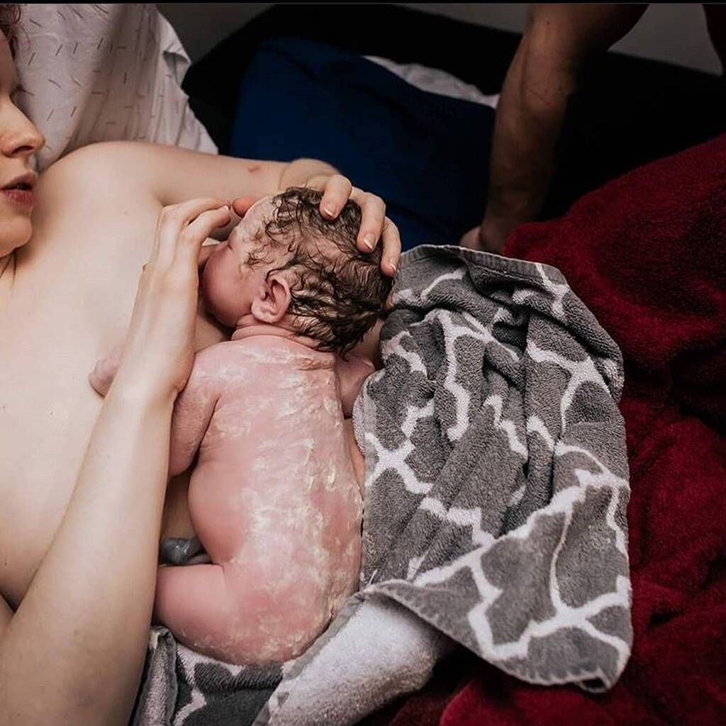 These photographs depict newborns with fetal sebum