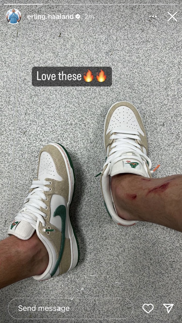 Erling Haaland showed off his battle wounds last night