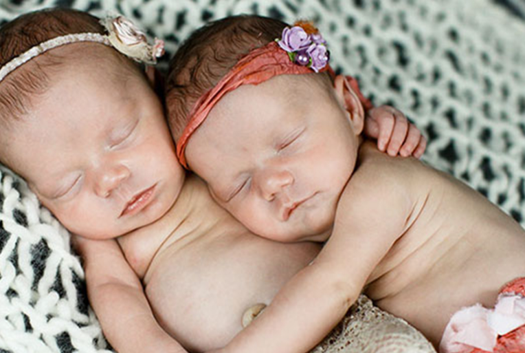 Twins grasping hands after birth: the bond of blood and the divine