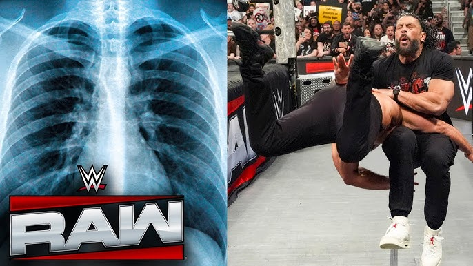 Cover Image for 💔😳🔥 Roman Reigns mis à terre par une attaque destructrice blessure aux côtes confirmée à Clash in Paris panique dans l’arène (vidéo) 🎥🚨⚡